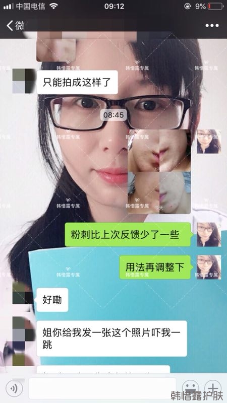 粉刺多怎么辦？按照要求配套耐心使用，粉刺消下去不少！