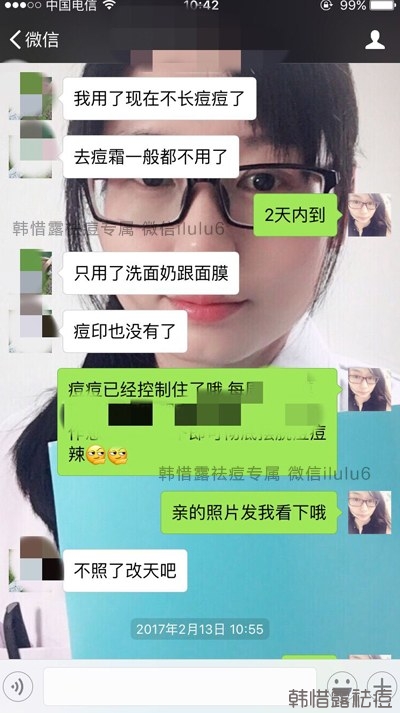 痘痘好了，再也沒有長過，懷孕8個月了！