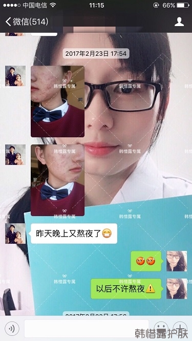 臉上長痘痘怎么去掉？徹底告別痘痘，自卑到自信的蛻變！