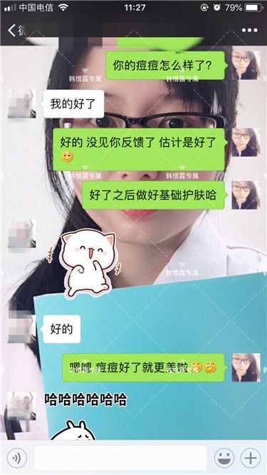 【視頻】臉上長粉刺怎樣去掉？醫院都沒搞定韓惜露幫我搞定了，超級開心！