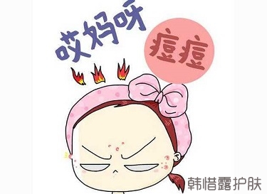 快速祛痘的方法有哪些？