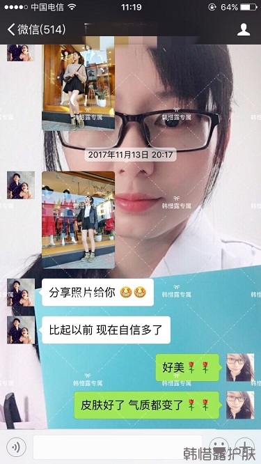 臉上長痘痘怎么去掉？徹底告別痘痘，自卑到自信的蛻變！