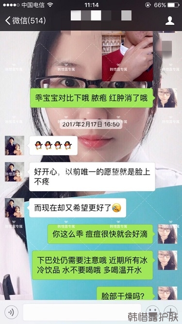 臉上長痘痘怎么去掉？徹底告別痘痘，自卑到自信的蛻變！
