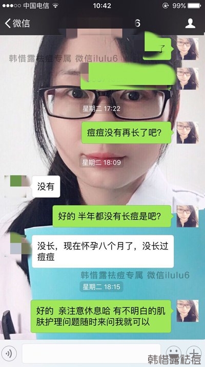 痘痘好了，再也沒有長過，懷孕8個月了！