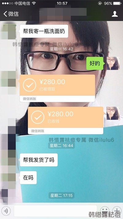 痘痘好了，再也沒有長過，懷孕8個月了！