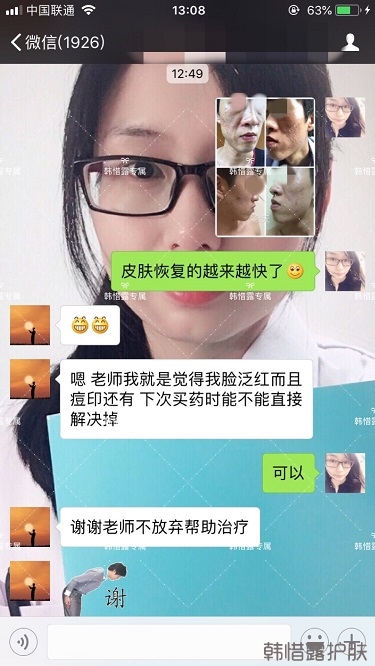 長痘痘找韓惜露，祛痘效果反饋